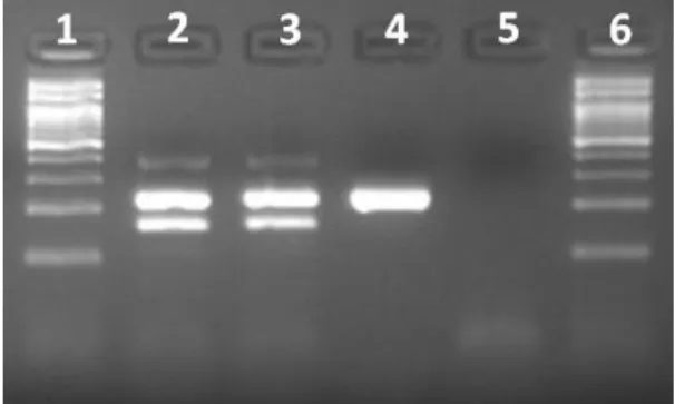 Figure  1 .   Characterization  of  the  Clostridium  difficile  isolates  by  multiplex  PCR