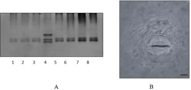 Figure 1- A.  Species-specific esterase phenotypes of Meloidogyne arenaria on Polyacrylamide gel (7 % gradient)