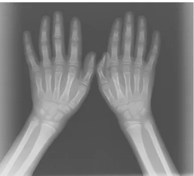 Figura 3.2 – Radiografia de mão e punho típica encontrada em hospitais e   clínicas brasileiros