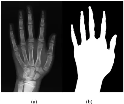 Figura 6.2 – (a) Imagem da radiografia ; (b) imagem binarizada. 