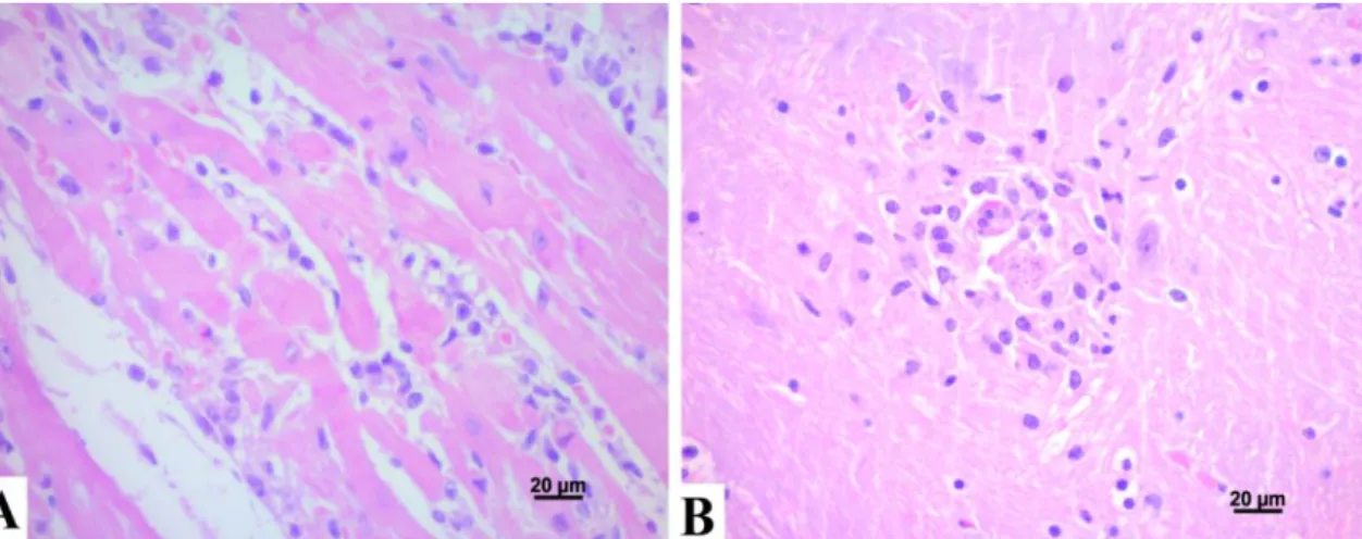 Figura  1.  Coração  (A):  evidencia-se  necrose  multifocal  de  miofibras  associada  a  infiltrado  moderado  linfoistioplasmocitário