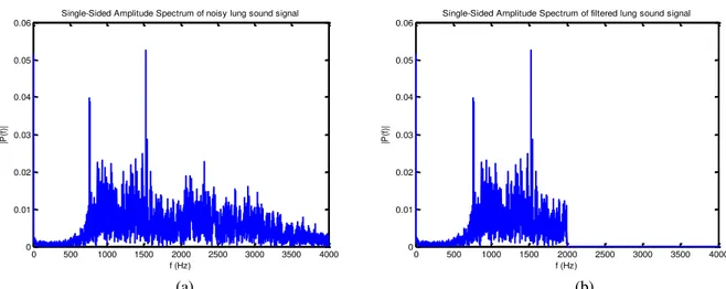 Figure 4. Single-Sided Amplitude Spectrum of: (a) noisy lung sound signal and, (b) filtered lung sound signal