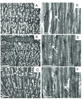 FIGURE 3 Radial and transverse sections, and dissociated cell  of  Casearia sylvestris from Mata Atlântica