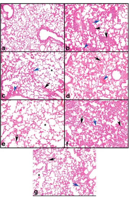 Figure 3 - a-g: Effects of Aliskiren treatments on light micrographs in rats’ lung tissues