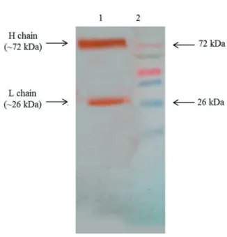 Figure 2 - Western blot analysis of rabbit anti-pacu IgM hy- hy-perimmune serum. Pacu total serum (lane 1) and molecular  weight marker (lane 2).
