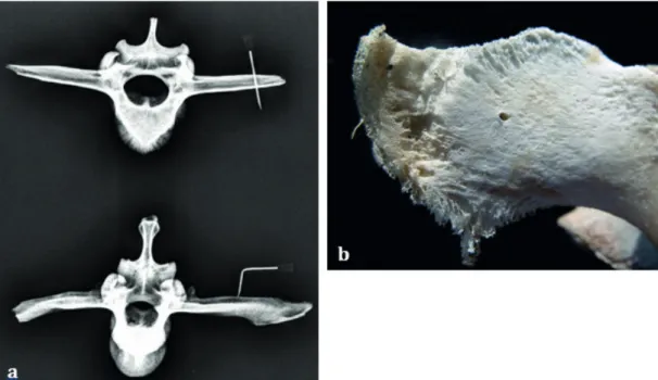 Figure 5  - a. Radiography of the lumbar vertebrae of a positive (top left) and a negative cattle (bottom left) for the  needle test