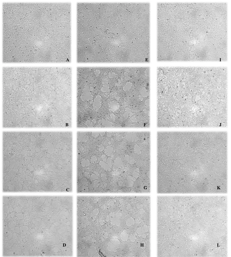 Figure 10- Microscopic analysis of HEK-293 cells in three types of treatment. Pictures A, B, C and D correspond to the cells  in the treatment without synchronization (WS)