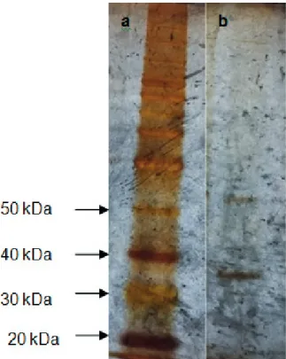 Figure 4 -  Polyacrylamide denaturing gel (12% SDS-PAGE). 