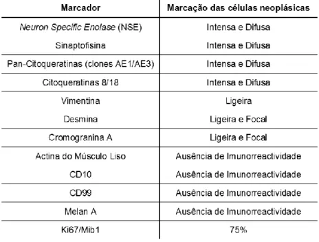 Tabela 1 – Registo dos resultados nas marcações imunohistoquímicas da neoplasia. 