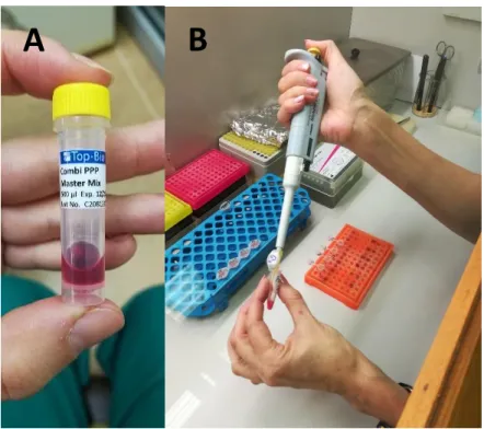 Figure 4: A - Master mix required in solution preparation for PCR. This mixture contains the necessary  enzyme, deoxyribonucleotides, reaction buffer components and other additives