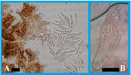 Figure 1. Asci and ascospores observed on E. dunnii leaves from the study areas. (A): Asci and ascospores; 