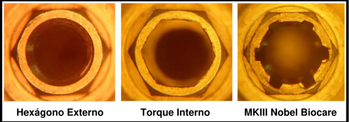Figura 12. Imagens dos implantes de cada grupo analisado no microscópio  óptico mono ocular