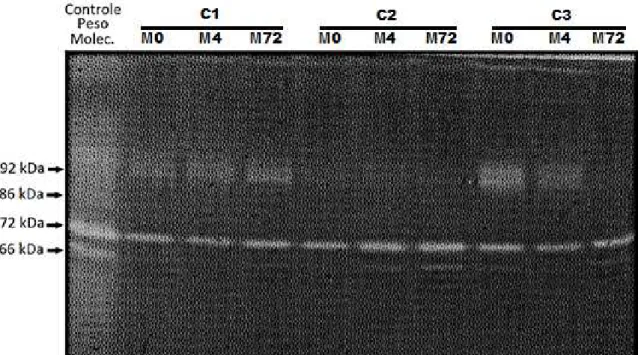 Figura 1. Zimograma representante das amostras de tecido laminar do casco, dos três momentos (M0, M4,  M72)  de  três  equinos  submetidos  à  obstrução  intraluminal  do  cólon  menor  (C1,  C2,  C3),  no  qual  a  primeira  coluna  é  o  controle  de  pe