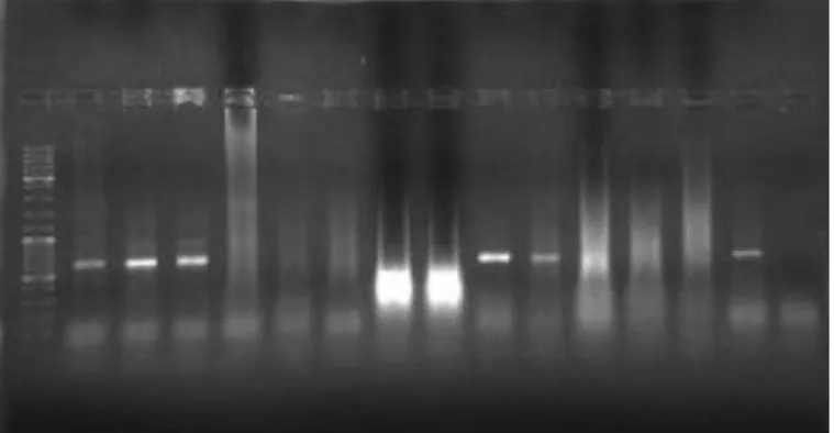 Figura  5:  Gel  de  agarose  após  amplificação  por  PCR,  para  deteção de Nocardia spp., demonstrando a banda de 596 bps.