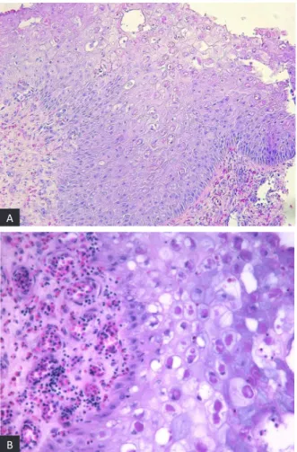 Table 1. Samples with presence (P)/absence (A) of  intracytoplasmic eosinophilic inclusion bodies, classification 
