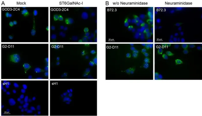 Fig.  4.  Immunofluorescence  staining  of  mock  and  ST6GALNAC1  transfected  MKN45  cells