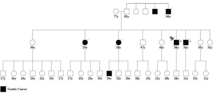 Figure 3 - Molecular analysis presenting exon 12 CDH1 mutation, c.1849T &gt; G. (a) Integrative Genomics Viewer - IGV TM software result; (b) Sanger se- se-quencing analysis of the patient; (c) Sanger sese-quencing analysis of a control case.