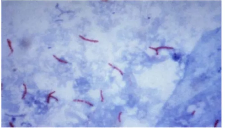 Figura 1. Fotomicrografia de micobactéria  corada pela técnica de Ziehl-Neelsen. Fonte: 