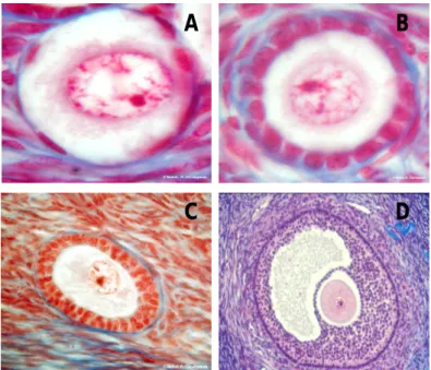 Figure  4:  Human  ovarian  follicles  at  the  primordial  stage  (A),     the  primary  stage  (B),the  secondary  stage  (C)  and       the antral stage (D) 