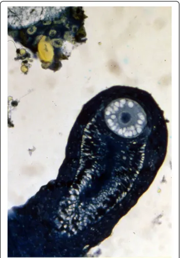 Fig. 10 Storage of spermatozoa in glandular tissue of the buthid Centruroides barbudensis