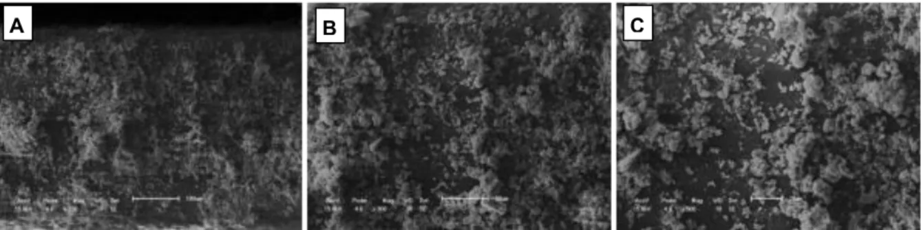 Figure  5  also  shows  a  higher  amount  of  material  from  the  water  with  calcium  deposited  in  the  dripper  Streamline  (Figure  5C)  when  compared  to Taldrip and Tiran (Figure 5F and I, respectively)