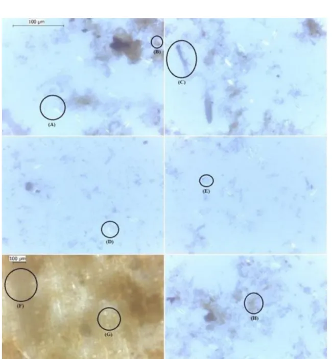 Figure 2. Identification of the main microbiological components in the inside of dripper tubes operated with water supply: 