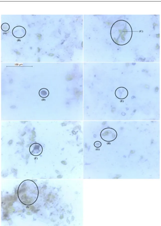 Figure  3. Identification of the main microbiological components in the inside of dripper tubes operated with wastewater: 