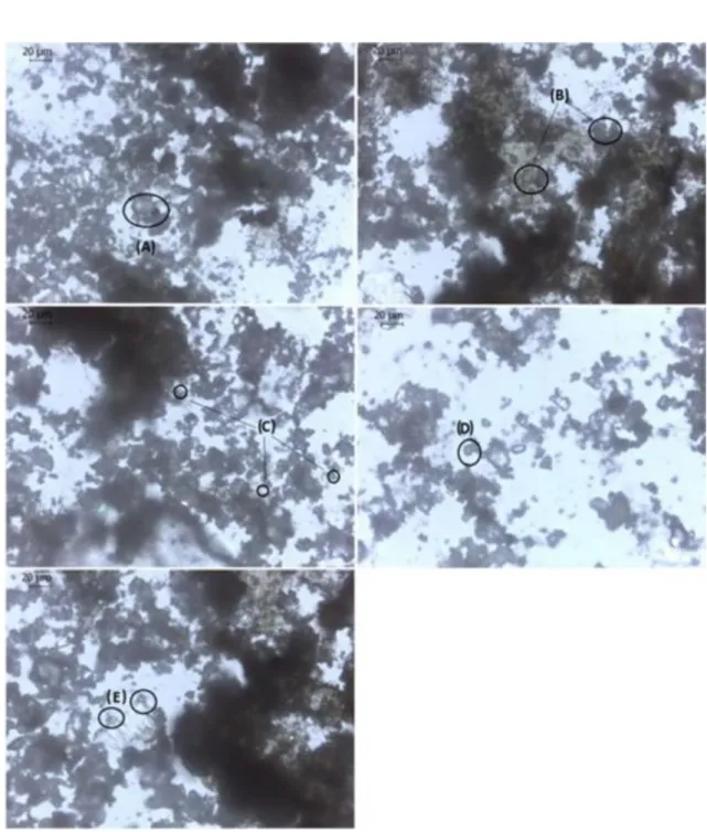 Figure 4. Identification of the main microbiological components in the material inside the dripper tubes operated with water  with  calcium:  A)  fecal  coliforms;  B)  suggestive  form  of  helminth  egg;  C)  Microcystis  aeruginosa;  D)  Suggestive  of 