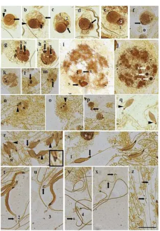 Figure 1. Behavior of silver-positive structures in the spermiogenesis of Chariesterus armatus (Coreidae, Heteroptera)