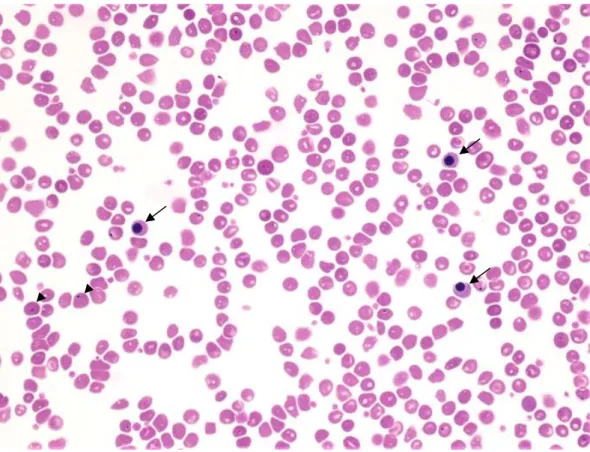 Figura  3  NRBC  (setas  pretas)  com  figuras  de  mitose  (seta  da  direita),  eritrócitos  policromatófilos  (cabeça de seta) e monócito (seta preta grande) numa amostra de sangue de cão