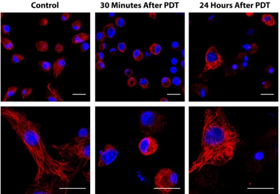 Figure 9. Changes of α-tubulin in HT-1376 cells 30 min and 24 h after targeted PDT with PorGal 8.