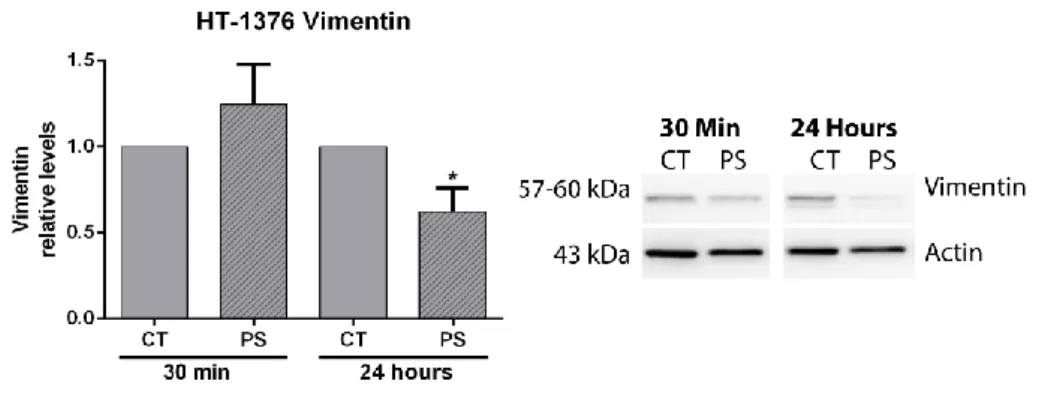 Figure  11.  PorGal 8   reduces  vimentin  protein  levels  after  photodynamic  activation  in  HT-1376  cells