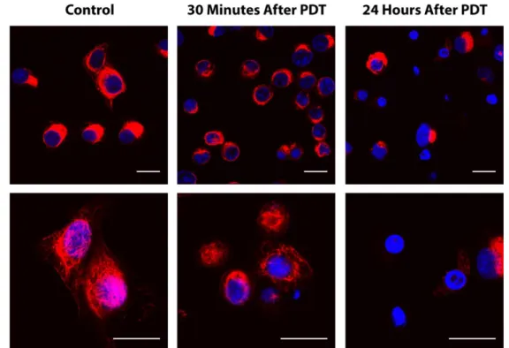Figure 12. Changes of vimentin in HT-1376 cells 30 min and 24 h after targeted PDT with PorGal 8.