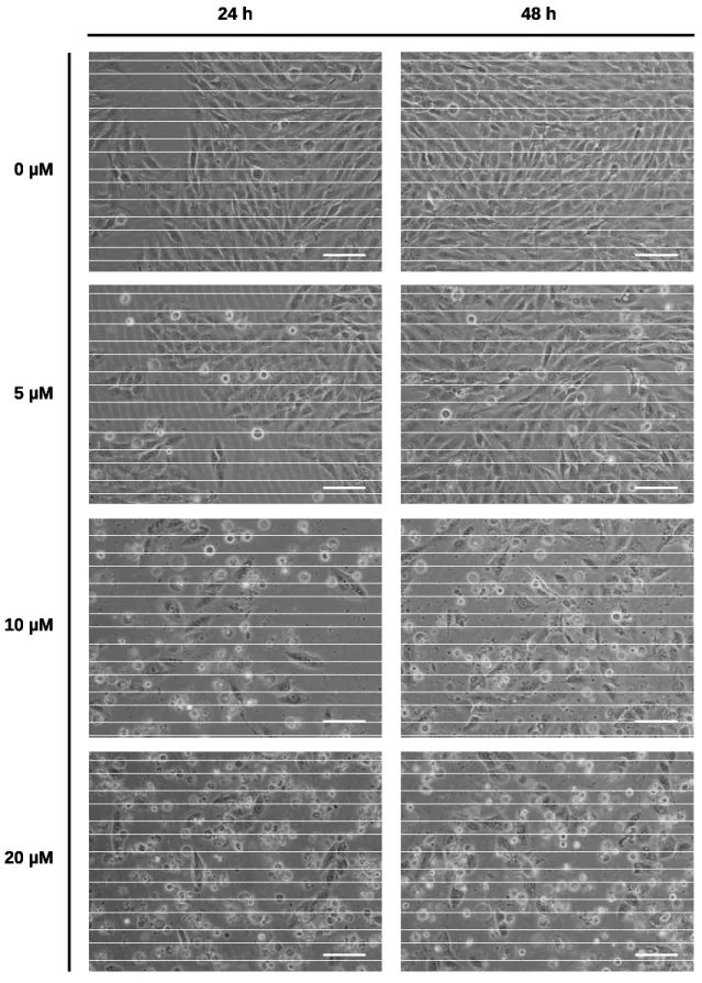 Figure  6.  Microscopic  visualization  of  control  and  sulforaphane-treated  MG-63  cells
