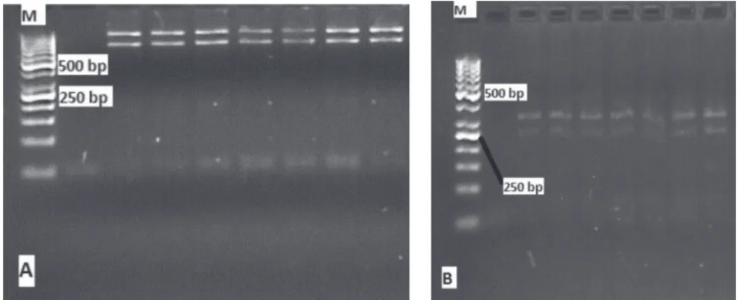 Figure 4 - Digestion results of exon 3 of PRL gene.