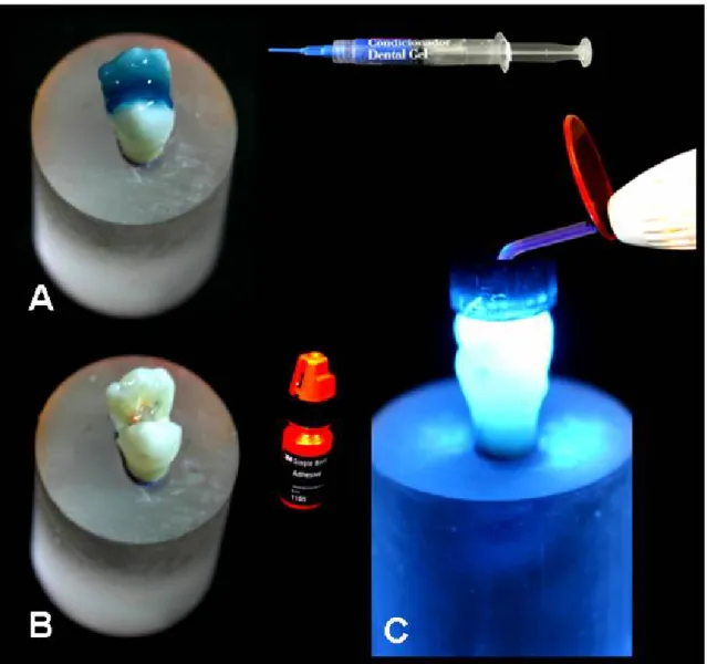 Figura 4. Protocolo de hibridização de estruturas dentais realizado para  confecção de todas as restaurações diretas e indiretas; A
