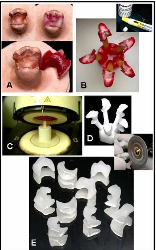 Figura 7. Confecção das restaurações indiretas em cerâmica; A. Confecção do  padrão de cera; B