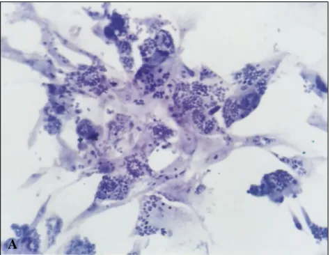 Figura 5. Efeito do pré-tratamento de T. gondii com heparina solúvel sobre a infecção de  células  de embrião  de  galinha  (E8)