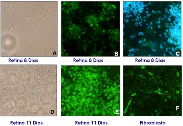 Figura 9. Fotomicrografia de células da retina e fibroblasto de embriões de galinha. A e D,  campos B e  E, vistos em Nomarski