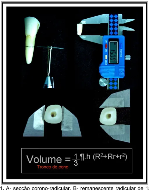 Figura 1. A- secção corono-radicular, B- remanescente radicular de 15,0 mm,  C- medida mesio-distal, D- medida vestibulo-lingual,  E- Fórmula matemática  utilizada para cáculo do volume das raízes