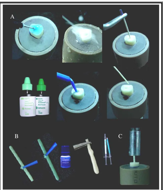 Figura 6. A- Protocolo de tratamento do remanescente dental, B- Protocolo de  tratamento 