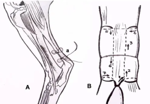 Figura  1.  Representação  esquemática  da  tenorrafia  do  tendão  do  ventre  lateral  do  músculo  gastrocnêmio  de  coelho