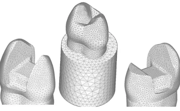Figura 11. Malha gerada nos modelos inlay, hígido e onlay, respectivamente 