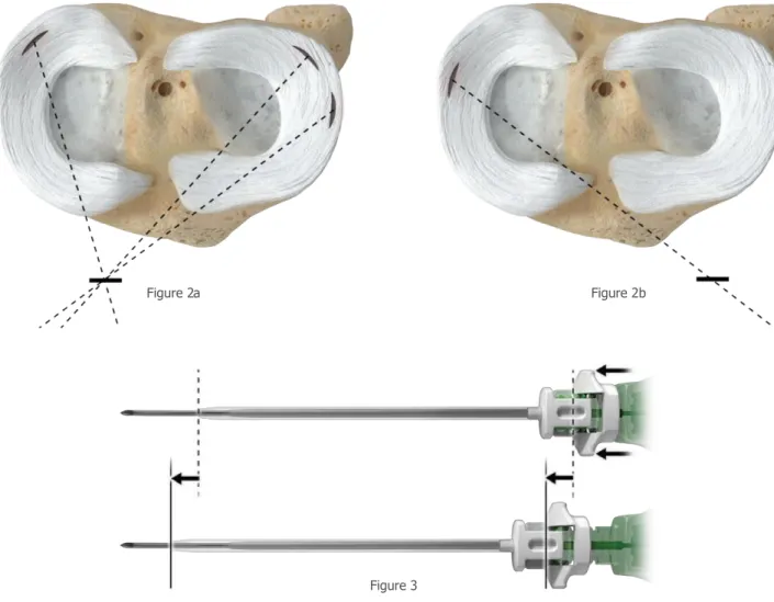 Figure 2a Figure 2b 