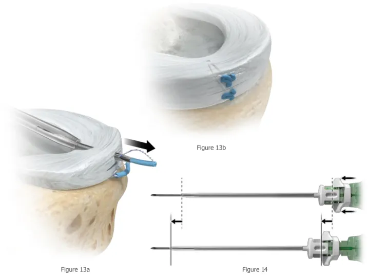 Figure 14Figure 13a 