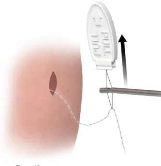 Figure 17 Figure 18 