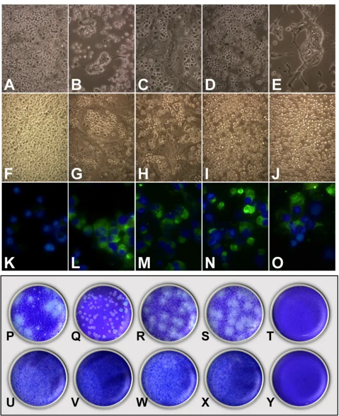 Fig. 3 – Infection and quantification of C6/36HT cells. Upper panel: Cells were infected with viral isolates and reference viruses; at 11 days post-infection, the cytopathic effect was documented (A–J), and the presence of viral antigen was confirmed by di