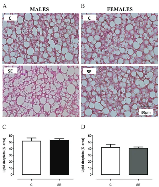 Figure 3. Long-term effects of neonatal cigarette smoke exposure on brown adipose tissue (BAT) morphology