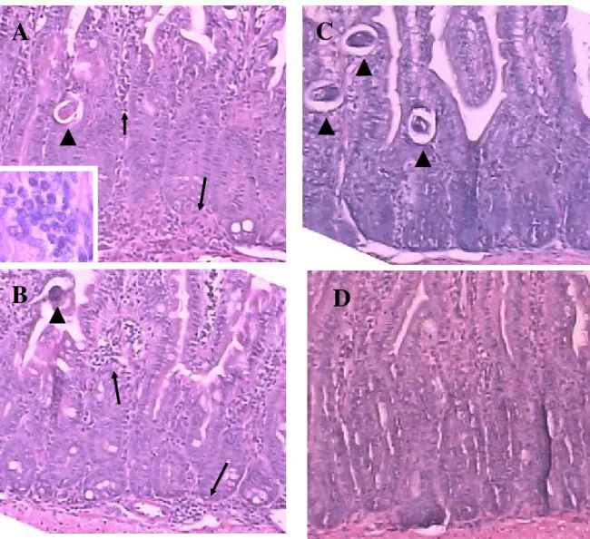 Figura 5 – Fotomicrografia do duodeno de camundongos WT infectados por S. venezuelensis  no  dia  8  p.i