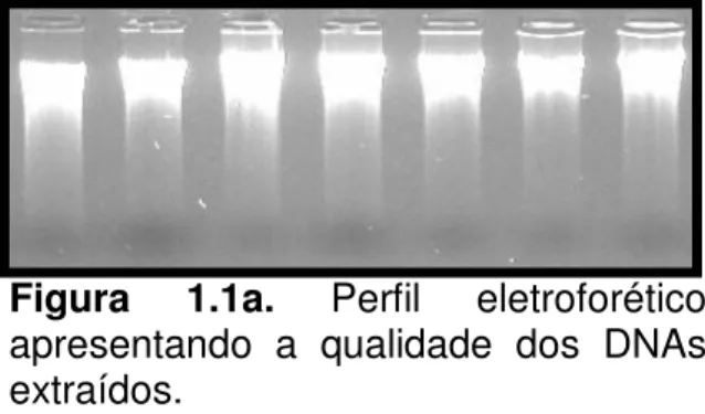 Figura  1.1b.  Amplificação  do  Exon 4 do gene TP53. Colunas  1-6:  amplificação  exon  4  do  gene  TP53;  M  =  marcador  molecular  100  pb;  Coluna  7:  controle  negativo (sem DNA)